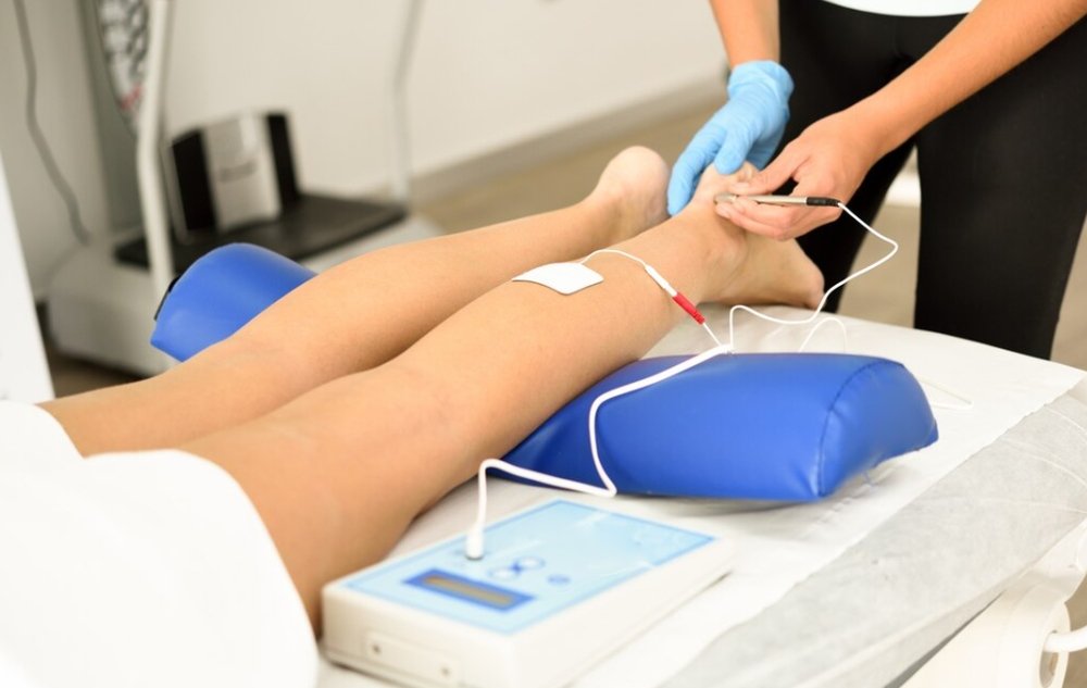 vein treatment