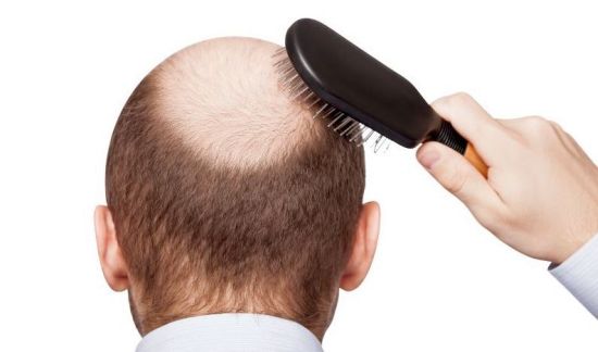 Hair zinc loss and Zinc For