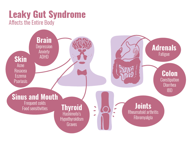 10 Symptoms You Have a Leaky Gut—and How to Heal It_leaky gut heath effects