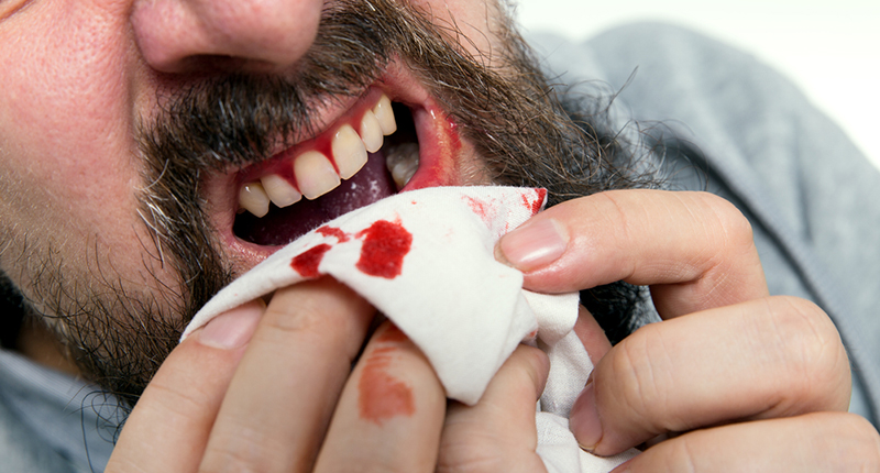 7 Reasons why your Bleeding Gums Need Attention_bleeding gums_ man